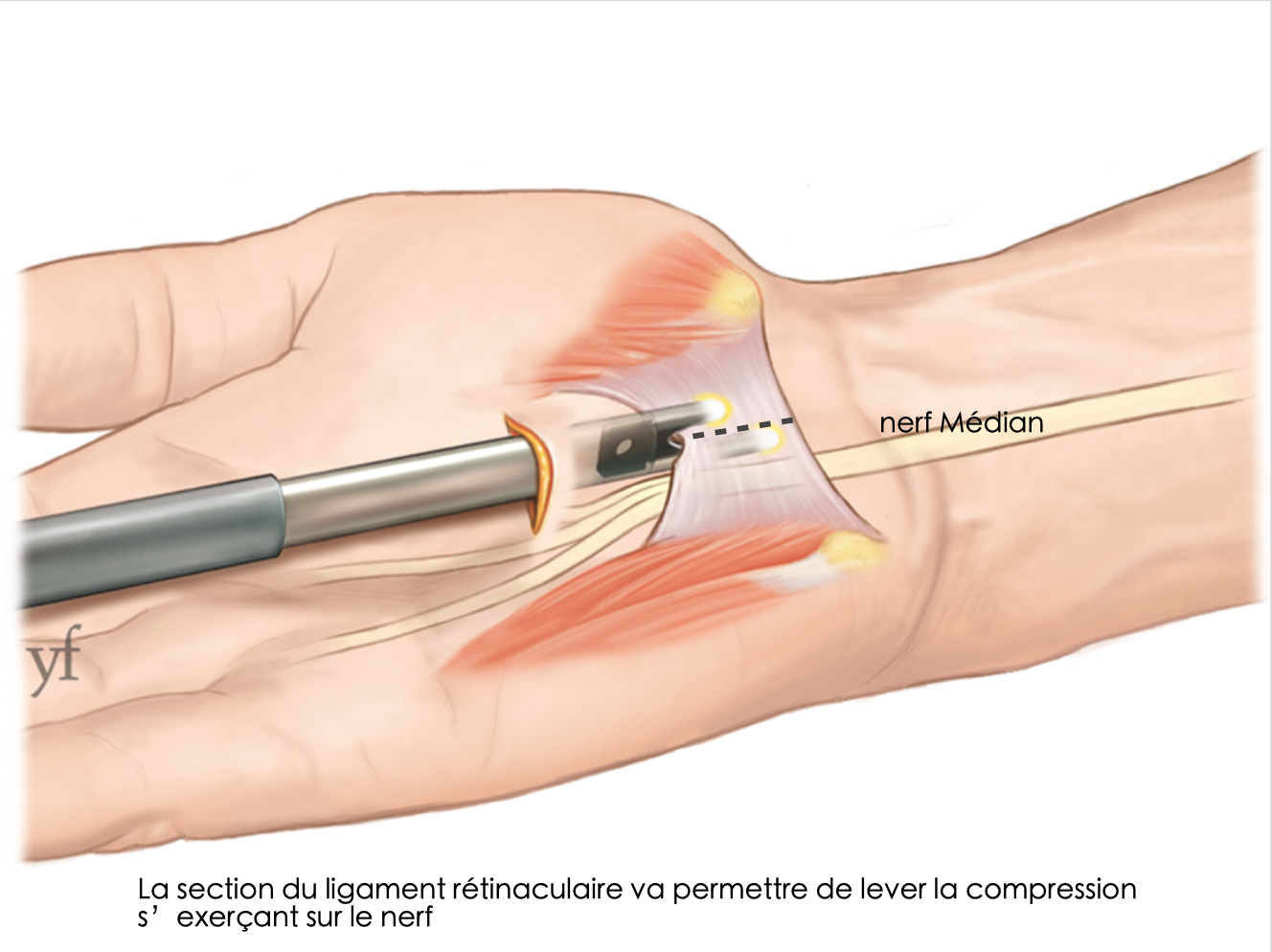 Anatomie du canal carpien