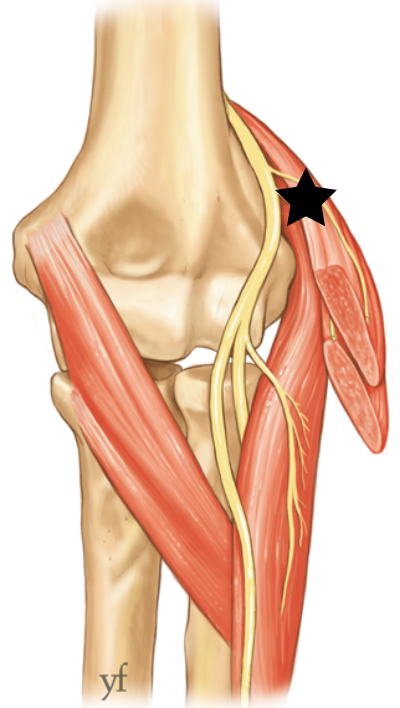 Anatomie épicondylite